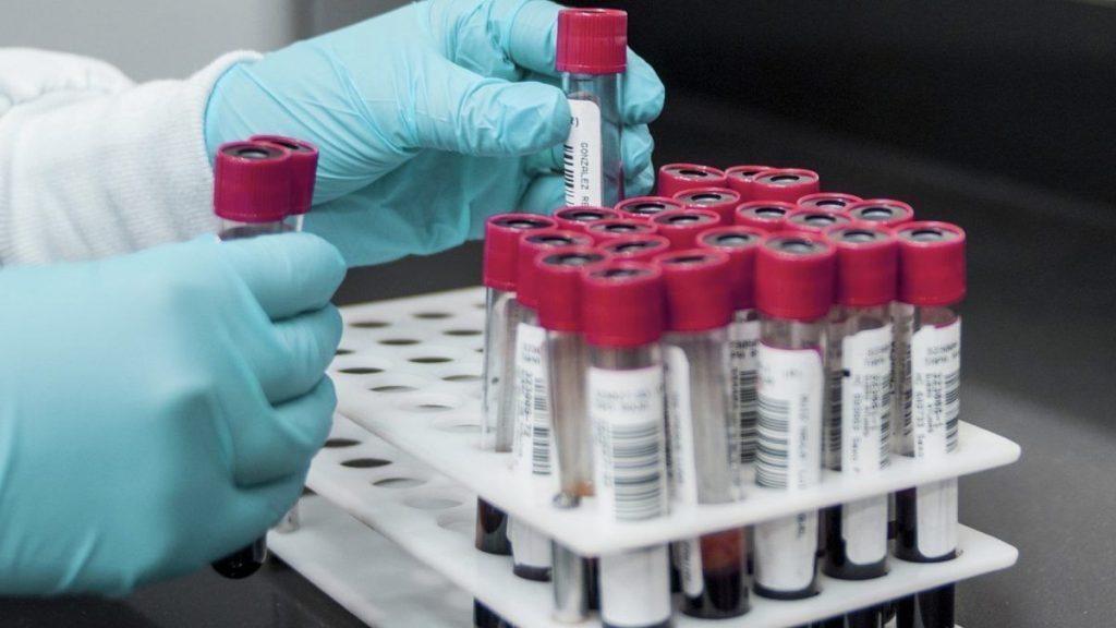 Gloved Hands Handling Small Vials with Red Caps in a White Rack in a Laboratory Setting, Labels Visible on the Vials. - Enbroncados