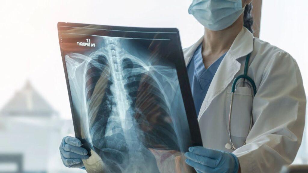 Doctor in Mask and Gloves Holds a Chest X-ray, Examining Lungs and Spine in a Clinical Setting. - Enbroncados