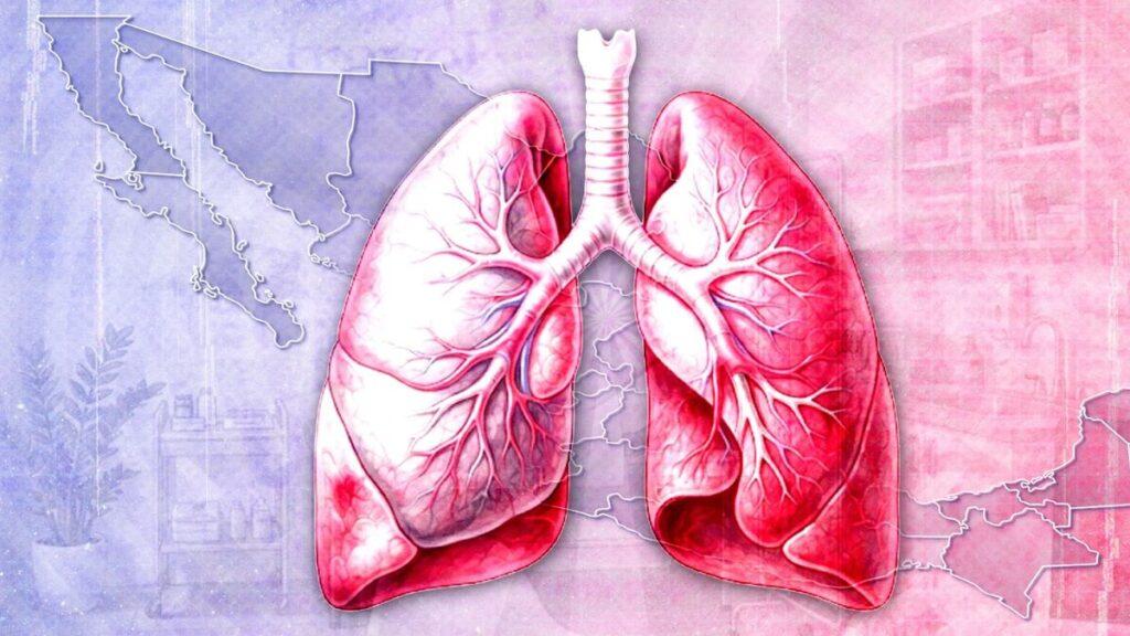 Anatomical Illustration of the Human Lungs and Trachea with Branching Airways Against a Pastel Map-like Background. - Enbroncados